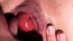 Prolapse licking